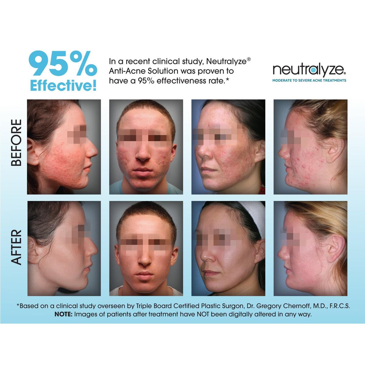 Acne Moisturizer Promo Code - RebateKey