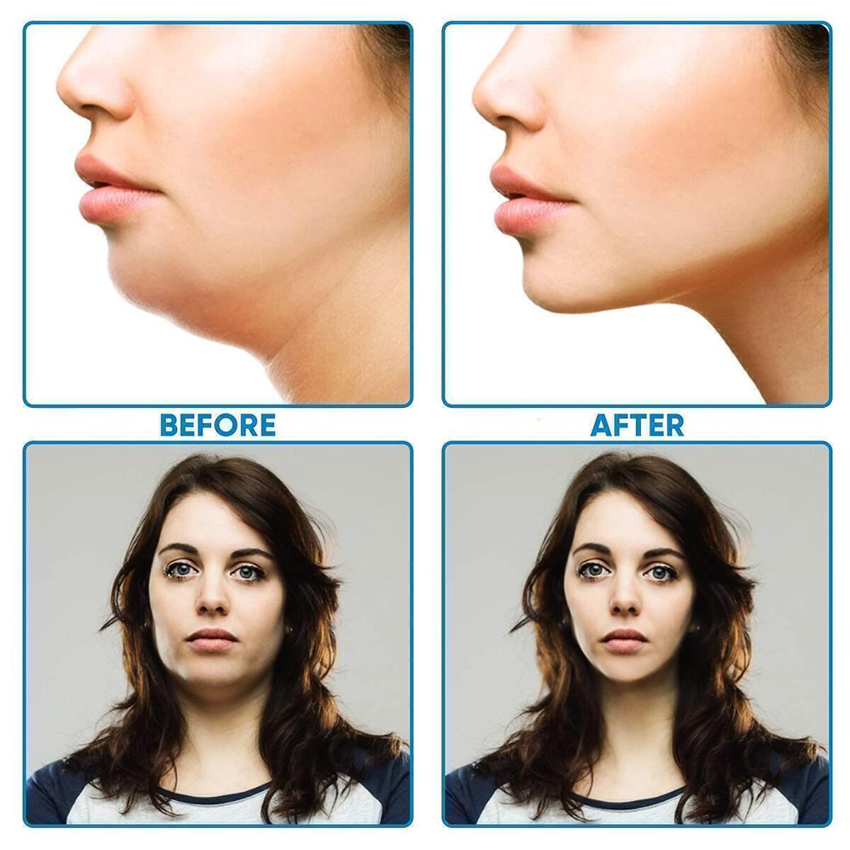 V Shaped Slimming Face 1 Cashback - RebateKey