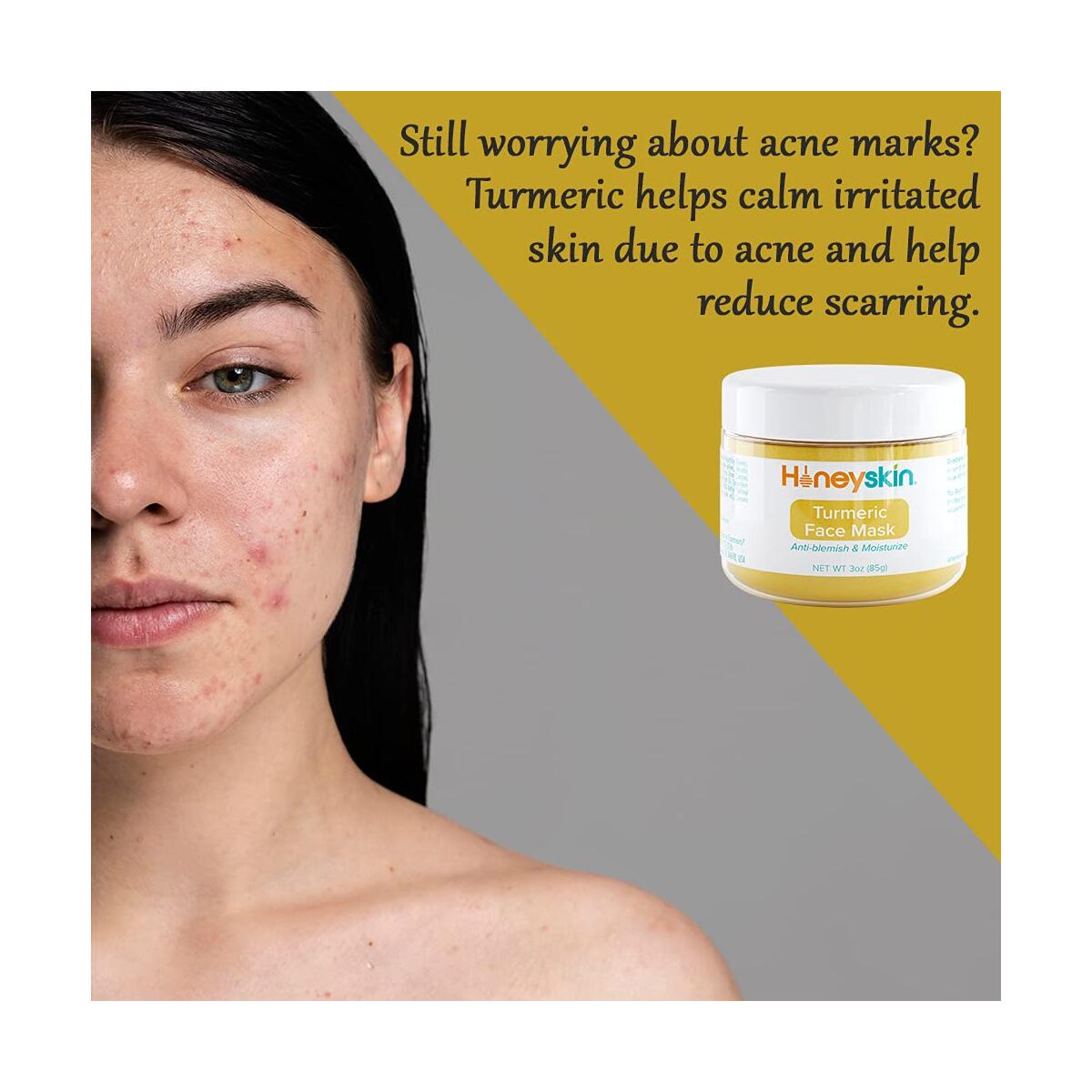Turmeric Face Mask 2 Cash Back - RebateKey