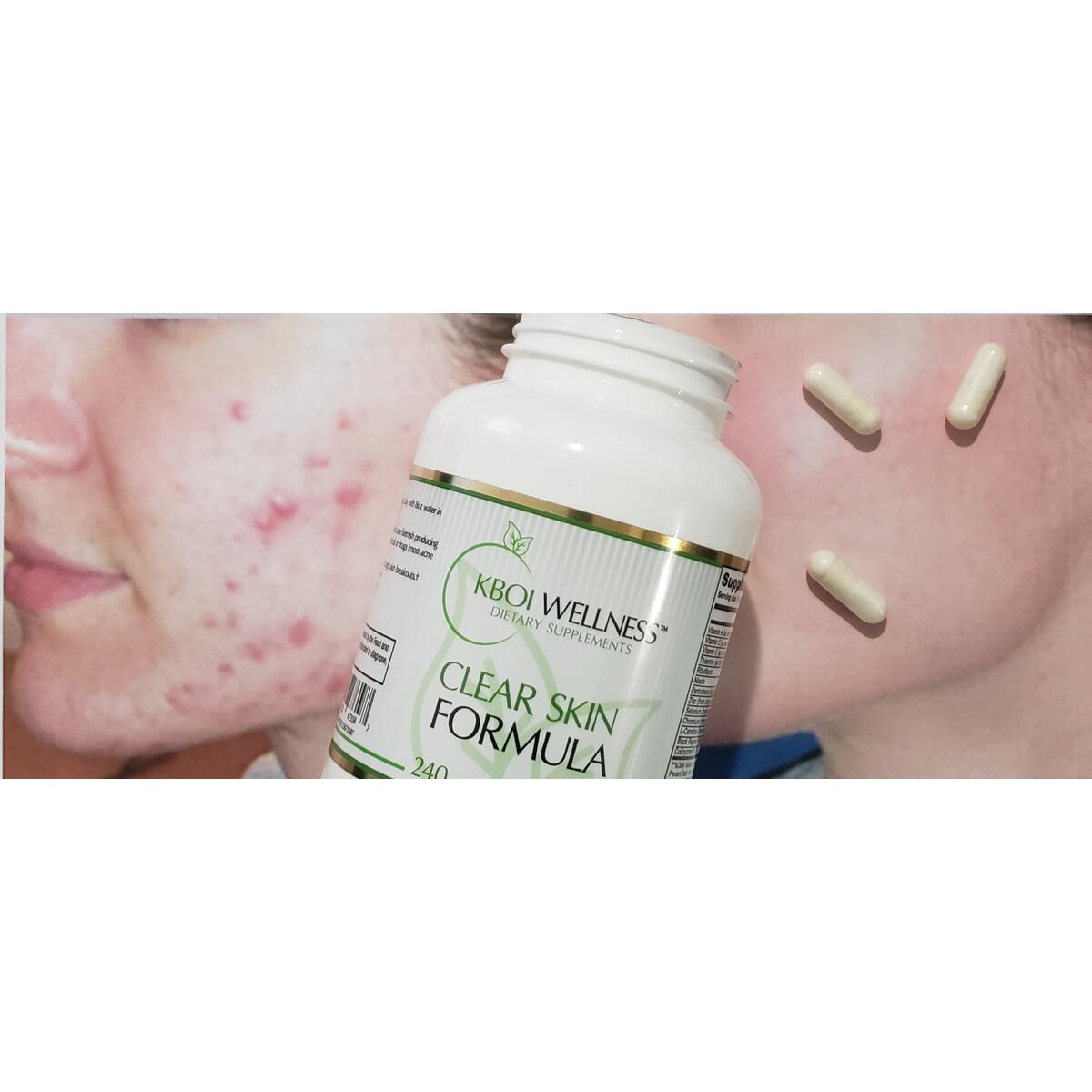 Clear Skin Formula (For Acne/Pimples)